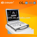 promotionspreis sonoscape farbe doppler ultraschall maschine portable &amp; ultraschall maschine sonoscape